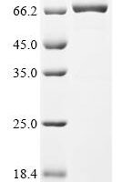 Human cytomegalovirus Immediate early protein IE1 (UL123) Recombinant Protein - BioCrest Sci
