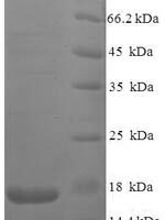Human immunodeficiency virus type 2 subtype A Protein Vpx (vpx) Recombinant Protein, N-His - BioCrest Sci