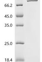 Escherichia coli Colicin-Ia (cia) Recombinant Protein, N-His - BioCrest Sci