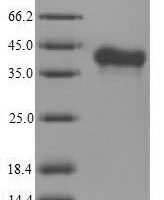 Mouse Tumor necrosis factor ligand superfamily member 11 (Tnfsf11), partial Recombinant Protein - BioCrest Sci