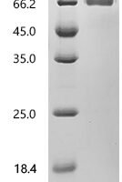Mouse Interferon gamma receptor 1 (Ifngr1), partial Recombinant Protein - BioCrest Sci