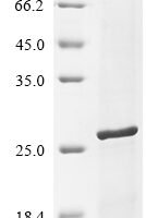 Vaccinia virus RNA-binding protein OPG065 (OPG065) Recombinant Protein - BioCrest Sci