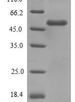 Salmonella enterica I Flagellin (fljB) Recombinant Protein, N-His - BioCrest Sci