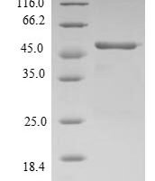 Human Ras-related protein Rap-2b (RAP2B) Recombinant Protein - BioCrest Sci