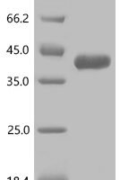 Human Peptidoglycan recognition protein 3 (PGLYRP3), partial Recombinant Protein - BioCrest Sci