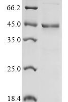 Human NAD (+) hydrolase SARM1 (SARM1), partial Recombinant Protein, N-His-KSI - BioCrest Sci