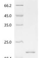 Mouse General transcription factor II-I (Gtf2i), partial Recombinant Protein - BioCrest Sci