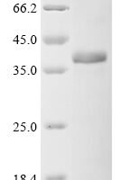 Human Complement component C9 (C9), partial Recombinant Protein, N-10His/C-Myc - BioCrest Sci