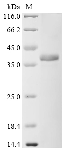 Human Complement component C9 (C9), partial Recombinant Protein, N-10His/C-Myc, Homo sapiens (Human), E.coli, N-terminal 10xHis-tagged and C-terminal Myc-tagged, 35.3 kDa, purity >≥ 85% as determined by SDS-PAGE.