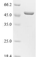 Mouse Angiopoietin-like protein 8 (Angptl8) Recombinant Protein, N-His-GST - BioCrest Sci