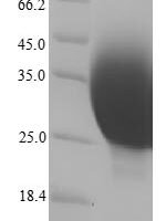 Human Metallothionein-1X (MT1X), partial Recombinant Protein, N-His - BioCrest Sci