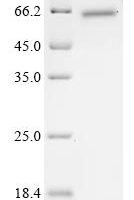 Human Transcription intermediary factor 1-beta (TRIM28), partial Recombinant Protein, N-His-GST - BioCrest Sci
