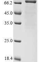 Human Desmoglein-2 (DSG2), partial Recombinant Protein, N-10His/C-Myc - BioCrest Sci