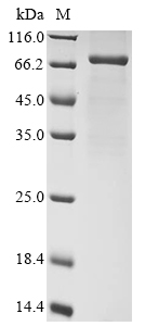 Human Desmoglein-2 (DSG2), partial Recombinant Protein, N-10His/C-Myc, Homo sapiens (Human), E.coli, N-terminal 10xHis-tagged and C-terminal Myc-tagged, 67.5 kDa, purity >≥ 85% as determined by SDS-PAGE.