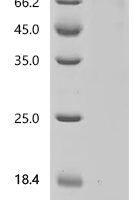 Human Acyloxyacyl hydrolase (AOAH) Recombinant Protein, C-hFc1 - BioCrest Sci