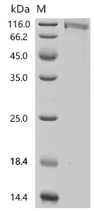 Human Acyloxyacyl hydrolase (AOAH) Recombinant Protein, C-hFc1, Mammalian cell, C-terminal hFc1-tagged, 90.0 kDa, purity >≥ 85% as determined by SDS-PAGE.
