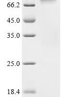 Human Zinc finger protein 410 (ZNF410) Recombinant Protein - BioCrest Sci