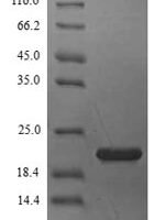 Blattella germanica Allergen Bla g 4 Recombinant Protein - BioCrest Sci