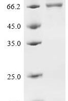 Human Butyrophilin-like protein 2 (BTNL2), partial Recombinant Protein, C-hFc1, aa 29–235 & 356–457 - BioCrest Sci