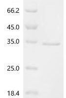 Mouse Alpha-actinin-1 (Actn1), partial Recombinant Protein - BioCrest Sci
