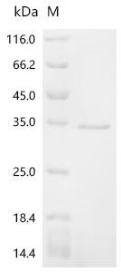 Mouse Alpha-actinin-1 (Actn1), partial Recombinant Protein, Mus musculus (Mouse), E.coli, C-terminal 6xHis-tagged, 32.0 kDa, purity >≥ 95% as determined by SDS-PAGE.