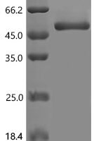 Human Apoptosis-associated speck-like protein containing a CARD (PYCARD), partial, Biotinylated Recombinant Protein - BioCrest Sci