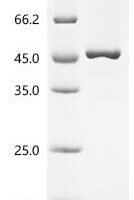 Rickettsia slovaca Citrate synthase (gltA) Recombinant Protein, C-His, aa 1–435, Yeast - BioCrest Sci