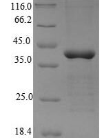 Human 5'-AMP-activated protein kinase subunit gamma-2 (PRKAG2) Recombinant Protein - BioCrest Sci