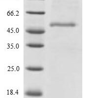 Human Endophilin-B2 (SH3GLB2) Recombinant Protein - BioCrest Sci