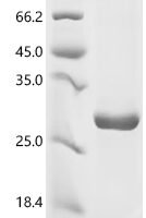 Human Focadhesin (FOCAD), partial Recombinant Protein, N-His/C-His - BioCrest Sci
