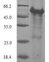 Human 39S ribosomal protein L28, mitochondrial (MRPL28) Recombinant Protein - BioCrest Sci
