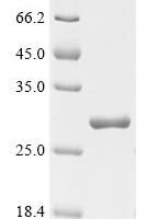 Trichoderma harzianum Endo-1,4-beta-xylanase Recombinant Protein, C-His, aa 1–190, E.coli - BioCrest Sci