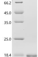 Chicken Fibroblast growth factor 1 (FGF1) Recombinant Protein, N-His - BioCrest Sci