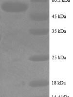 Human Intestinal-type alkaline phosphatase (ALPI), partial Recombinant Protein - BioCrest Sci