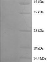 Human U1 small nuclear ribonucleoprotein A (SNRPA), partial Recombinant Protein - BioCrest Sci