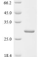 Human Hepcidin (HAMP), partial Recombinant Protein - BioCrest Sci