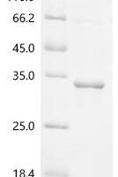 Babesia gibsoni Thrombospondin-related adhesive protein (BgTRAP), partial Recombinant Protein - BioCrest Sci