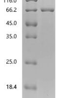 Human NAD(+) hydrolase SARM1 (SARM1), partial Recombinant Protein - BioCrest Sci