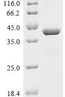 Human Serine/threonine-protein phosphatase PP1-gamma catalytic subunit (PPP1CC) Recombinant Protein - BioCrest Sci