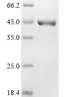 Human DNA fragmentation factor subunit beta (DFFB) Recombinant Protein - BioCrest Sci