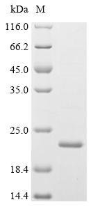 Rabbit Prolactin-inducible protein homolog (PIP) Recombinant Protein, Oryctolagus cuniculus (Rabbit), E.coli, C-terminal 6xHis-tagged, 20.6 kDa, purity >≥ 85% as determined by SDS-PAGE.