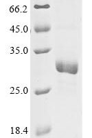 Chlamydia trachomatis Virulence plasmid protein pGP3-D Recombinant Protein, N-His - BioCrest Sci