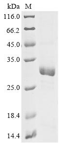 Chlamydia trachomatis Virulence plasmid protein pGP3-D Recombinant Protein, N-His, Chlamydia trachomatis, E.coli, N-terminal 6xHis-tagged, 31.9 kDa, purity >≥ 85% as determined by SDS-PAGE.
