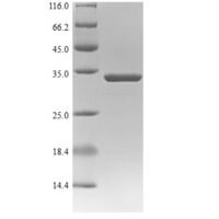 Sudan ebolavirus  Nucleoprotein (NP), partial Recombinant Protein - BioCrest Sci
