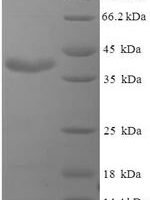 Pig Prolactin (PRL) Recombinant Protein, N-His-SUMO - BioCrest Sci