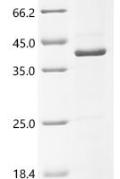 Human Pendrin (SLC26A4), partial Recombinant Protein, C-His, aa 508–780 - BioCrest Sci