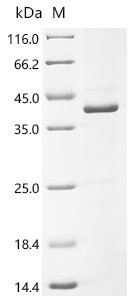 Human Pendrin (SLC26A4), partial Recombinant Protein, C-His, aa 508–780, Homo sapiens (Human), E.coli, C-terminal 6xHis-tagged, 37.9 kDa, purity >≥ 85% as determined by SDS-PAGE.