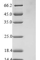 Bovine Cathelicidin-6 (CATHL6) Recombinant Protein - BioCrest Sci