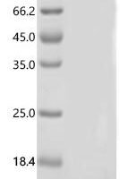 Human Calcitonin gene-related peptide 2 (CALCB), partial Recombinant Protein, C-His - BioCrest Sci
