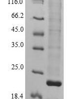 Human Lysine-specific demethylase 5A (KDM5A), partial Recombinant Protein - BioCrest Sci